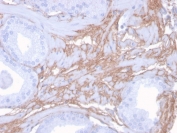 Decorin Antibody Human Prostate Tissue Immunohistochemistry. IHC staining of FFPE human prostate with Decorin antibody (clone DCN/3523). HIER: boil tissue sections in pH 9 10mM Tris with 1mM EDTA for 10-20 min and allow to cool before testing.