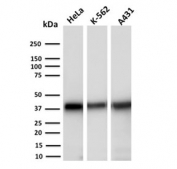 AKR1C2 Antibody Human Cell Line Panel WB. Western blot analysis of human HeLa, K562, and A431 cell lysates using AKR1C2 Antibody (clone CPTC-AKR1C2-1) detects a band at approximately 37 kDa, consistent with the predicted molecular weight of AKR1C2 / Aldo-keto reductase family 1 member C2. The banding pattern across multiple cell lines supports reliable detection of this cytosolic enzyme, aligning with its role in hormone metabolism and steroid regulation pathways.