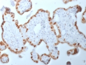 DNA Methyltransferase 1 Antibody Human Placenta IHC. Immunohistochemistry staining of FFPE human placenta using DNA Methyltransferase 1 antibody demonstrates prominent nuclear staining within trophoblastic epithelial cell populations lining placental villi, consistent with the expected nuclear localization of DNMT1. DNA Methyltransferase 1 is a DNA methylation maintenance enzyme responsible for preserving epigenetic patterns during cellular replication and plays a critical role in regulation of gene expression, chromatin organization, and developmental programming. The observed nuclear staining pattern is consistent with the importance of DNMT1-mediated epigenetic regulation in placental development and cellular differentiation. HIER: boil tissue sections in pH 9 10mM Tris with 1mM EDTA for 10-20 min and allow to cool before testing.