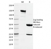 SDS-PAGE analysis of purified, BSA-free DNMT1 / DNA Methyltransferase 1 antibody as confirmation of integrity and purity.