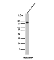 Desmocollin-2/3 Antibody Human Intestine WB. Western blot analysis of human intestine lysate using a recombinant monoclonal Desmocollin-2/3 antibody detecting DSC2 and DSC3, clone rDSC2/3437. A band is detected at approximately 95-110 kDa, consistent with the expected molecular weight of desmocollin proteins, which are calcium-dependent desmosomal cadherins expressed in epithelial tissues. The observed size range reflects known post-translational processing and glycosylation associated with these membrane adhesion proteins in intestinal epithelium.