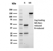 SDS-PAGE analysis of purified, BSA-free DSG3 antibody-microarray validated clone DSG3/2840 as confirmation of integrity and purity.