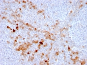 CD105 Antibody Human Tonsil IHC. Immunohistochemistry analysis of FFPE human tonsil tissue using CD105 Antibody (clone ENG/3269) demonstrates HRP-DAB brown membranous staining in endothelial cells of small vessels within the lymphoid tissue, consistent with Endoglin / CD105 expression as an endothelial marker, while surrounding lymphocytes remain largely negative; nuclei are counterstained blue. HIER: boil tissue sections in pH 9 10 mM Tris with 1 mM EDTA for 10-20 min and allow to cool before testing.