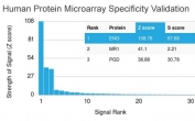 CD105 Antibody Microarray Specificity Validation. Analysis of HuProt(TM) microarray containing more than 19,000 full-length human proteins using CD105 Antibody (clone ENG/3269) demonstrates highly specific detection of Endoglin / CD105, an endothelial marker involved in angiogenesis and vascular biology. The antibody shows a dominant signal for ENG with clear separation from other proteins on the array, supporting strong target specificity of clone ENG/3269. Z- and S-score: The Z-score represents the strength of signal generated when the antibody binds to a protein on the array, expressed as standard deviations above the mean signal, while the S-score reflects the difference between sequential Z-scores and indicates relative specificity compared to potential off-target interactions.