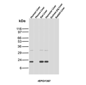 Erythropoietin Antibody Multi-Species Liver WB. Western blot analysis of liver tissue lysates from human, mouse, rat, hamster, guinea pig, and rabbit using Erythropoietin Antibody (clone rEPO/1367) detects bands consistent with EPO expression, with lower molecular weight species likely representing processed forms of this secreted glycoprotein, supporting cross-species detection across liver tissues.