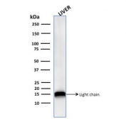 Cathepsin D Lysosomal Protease Antibody Liver WB. Western blot analysis of human liver lysate using Cathepsin D Antibody (clone CTSD/3276) detects a prominent band at approximately 14-15 kDa, corresponding to the light chain of mature Cathepsin D generated through proteolytic processing of the precursor protein. This banding pattern is consistent with lysosomal maturation of CTSD and reflects its active enzymatic form involved in intracellular protein degradation.