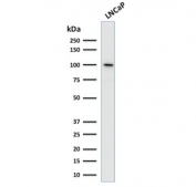Folate Hydrolase 1 Antibody LNCaP WB. Western blot analysis of human LNCaP cell lysate using Folate Hydrolase 1 Antibody / Folate Metabolism Marker. A strong band is detected at approximately 100 kDa, consistent with the predicted molecular weight of Folate hydrolase 1 / FOLH1, also known as Prostate-specific membrane antigen / PSMA. The observed signal is consistent with established FOLH1 expression in prostate-derived tumor cell models and supports its role as a membrane-associated metallopeptidase involved in folate metabolism and prostate cancer-associated signaling pathways.