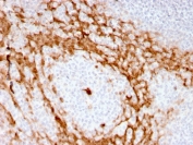 GCSF Antibody Human Tonsil Tissue Immunohistochemistry. IHC staining of FFPE human tonsil with GCSF antibody (clone CSF3/3166R). HIER: boil tissue sections in pH 9 10mM Tris with 1mM EDTA for 10-20 min and allow to cool before testing.