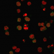 CD21 Antibody Cell Surface IF. Immunofluorescence analysis of Complement Receptor 2 / CD21 in PFA-fixed human MOLT4 cells using recombinant rabbit monoclonal CD21 antibody, clone CR2/3124R. Green fluorescence highlights membrane-associated and punctate CD21 signal consistent with receptor localization, while nuclei are counterstained with Reddot (red), providing cellular context.