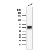 ALDH1A1 Antibody Liver WB. Western blot analysis of human liver lysate using ALDH1A1 Antibody / Gastric and Hepatic Detoxification Marker clone ALDH1A1/1381. A strong band is detected at approximately 55 kDa, consistent with the predicted molecular weight of Aldehyde dehydrogenase 1 family member A1 / ALDH1A1. The prominent hepatic signal aligns with the established role of ALDH1A1 in aldehyde detoxification, retinoic acid biosynthesis, and intermediary metabolic pathways within hepatocytes.