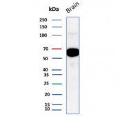 ALDH1A1 Antibody Brain WB. Western blot testing of human brain tissue lysate with ALDH1A1 antibody (clone ALDH1A1/1381). Expected molecular weight ~55 kDa.