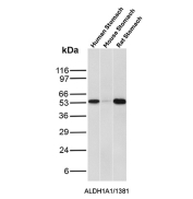 ALDH1A1 Antibody Stomach Tissue WB. Western blot analysis of human stomach, mouse stomach, and rat stomach tissue lysates using ALDH1A1 Antibody / Gastric and Hepatic Detoxification Marker clone ALDH1A1/1381. A distinct band is detected at approximately 55 kDa in human and rat stomach samples, consistent with the predicted molecular weight of Aldehyde dehydrogenase 1 family member A1 / ALDH1A1. The observed gastric expression pattern aligns with the established role of ALDH1A1 in epithelial aldehyde detoxification and retinoic acid metabolism within gastrointestinal tissues, while mouse stomach lysate shows comparatively low detectable signal under these experimental conditions.
