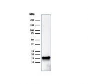 FABP5 Antibody HeLa WB. Western blot analysis of human HeLa cell lysate using FABP5 Antibody / Fatty Acid Transport and Metabolism Marker. A strong band is detected at approximately 15 kDa, consistent with the predicted molecular weight of Fatty acid-binding protein 5 / FABP5. The observed signal aligns with the established role of FABP5 in intracellular fatty acid trafficking, epithelial cell metabolism, and lipid-associated signaling pathways in proliferative cell populations.