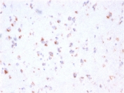 FCGRT Antibody Cerebellum IHC. Immunohistochemistry analysis of FFPE human cerebellum tissue stained with FCGRT Antibody / Neonatal Fc Receptor clone FCGRT/2932 following HIER in pH 9 Tris-EDTA buffer. Distinct HRP-DAB brown staining is observed in scattered neural-associated cell populations, consistent with expression of FcRn/FCGRT, a receptor involved in IgG transport, albumin recycling, and Fc-mediated barrier transport biology within neural tissues.