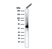 AMACR/p504S Antibody Human Kidney WB. Western blot testing of human kidney lysate with recombinant AMACR/p504S antibody (clone rAMACR/1864). Predicted molecular weight ~43 kDa.
