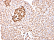 FTH1 Antibody Pancreas IHC. Immunohistochemistry staining of FFPE human pancreas tissue using FTH1 Antibody / Ferritin Heavy Chain 1 Antibody demonstrates diffuse granular cytoplasmic HRP-DAB brown staining throughout pancreatic epithelial and acinar-associated cell populations, with enhanced staining intensity in clustered glandular structures. The observed staining profile supports expression of Ferritin heavy chain 1 / FTH1 in metabolically active pancreatic tissue involved in intracellular iron sequestration and oxidative stress-associated homeostasis pathways. HIER: boil tissue sections in pH 9 10mM Tris with 1mM EDTA for 10-20 min and allow to cool before testing.