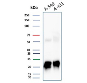 FTH1 Antibody Lung Carcinoma WB. Western blot analysis of human A-549 and A-431 cell lysates using FTH1 Antibody FTH/2081 demonstrates strong bands near 20-24 kDa corresponding to Ferritin heavy chain 1 / FTH1, with additional faint higher molecular weight signal likely representing ferritin-associated multimeric or incompletely denatured protein species. The observed expression profile supports the established role of FTH1 in intracellular iron sequestration, oxidative stress protection, and metabolic adaptation within epithelial carcinoma-derived cell lines.