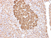 FTH1 Antibody Pancreatic Islet Cell IHC. Immunohistochemistry staining of FFPE human pancreas tissue using FTH1 Antibody / Ferritin Heavy Chain 1 Antibody demonstrates strong granular cytoplasmic HRP-DAB brown staining within clustered islet-associated endocrine cell populations with comparatively lighter surrounding exocrine tissue staining. The observed staining pattern is consistent with Ferritin heavy chain 1 / FTH1 expression in metabolically active pancreatic compartments involved in intracellular iron homeostasis and oxidative stress response pathways. HIER: boil tissue sections in pH 9 10mM Tris with 1mM EDTA for 10-20 min and allow to cool before testing.