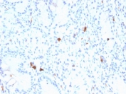 Gastrin Antibody Stomach IHC. Immunohistochemistry analysis of FFPE human stomach tissue stained with Gastrin Antibody demonstrates sparse cytoplasmic HRP-DAB brown staining within scattered gastrointestinal endocrine-associated cellular populations distributed throughout gastric glandular structures. This gastrointestinal hormone marker antibody highlights Gastrin / GAST-expressing neuroendocrine cells involved in gastric acid regulatory signaling and digestive peptide hormone-associated pathways. HIER: boil tissue sections in pH 9 10mM Tris with 1mM EDTA for 20 min and allow to cool before testing.