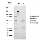 SDS-PAGE analysis of purified, BSA-free recombinant mouse monoclonal CELA3B antibody (clone rCELA3B/1811) as confirmation of integrity and purity.