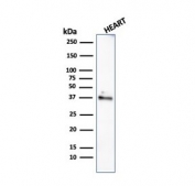 Western blot testing of human heart lysate with recombinant Histone H1 antibody (clone rAE-4). Predicted molecular weight ~20 kDa but can be observed at 27-33 kDa.