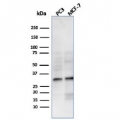 NKX2.8 Antibody WB. Western blot analysis of human PC-3 and MCF-7 cell lysates using NKX2.8 Antibody detects bands migrating between approximately 26-34 kDa, consistent with the predicted molecular weight of NKX2.8 and commonly observed migration patterns for homeobox-associated transcription factors. This homeobox transcription factor antibody highlights developmental regulatory signaling and lineage-associated transcriptional control pathways in epithelial-derived tumor cell lines.