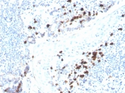 IHC IgA Heavy Chain Antibody Recombinant Mouse MAb rHISA43 in human tonsil. Immunohistochemistry analysis of IgA Heavy Chain Antibody Recombinant Mouse MAb rHISA43 in formalin-fixed paraffin-embedded human tonsil tissue. The recombinant mouse monoclonal antibody (clone rHISA43) shows cytoplasmic HRP-DAB brown staining in scattered plasma cells within the tonsillar lymphoid tissue, consistent with expression of Immunoglobulin alpha heavy chain (IGHA), the heavy chain component of IgA antibodies produced by differentiated B cells. Positive staining is primarily observed in plasma cells located within lymphoid regions, while surrounding lymphocytes remain largely negative. Antigen retrieval was performed by boiling tissue sections in pH 9 Tris-EDTA buffer (10mM Tris, 1mM EDTA) for 10-20 minutes followed by cooling prior to antibody incubation.