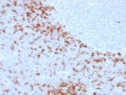 Human IgD Antibody Clone IgD26 immunohistochemistry analysis of human lymph node tissue. Formalin-fixed paraffin-embedded human lymph node tissue stained with Human IgD Antibody Clone IgD26 shows HRP-DAB brown chromogenic staining in B lymphocytes within lymphoid follicles. Positive cells are concentrated in mantle zone regions surrounding germinal centers and display membranous and cytoplasmic staining consistent with Immunoglobulin D expression in mature naive B lymphocytes. Heat induced epitope retrieval was performed by boiling tissue sections in pH 9 10mM Tris with 1mM EDTA for 10-20 minutes followed by cooling prior to antibody incubation.