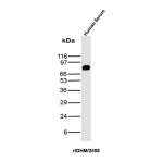 Recombinant IgM Heavy Chain Antibody rIGHM/2558 in Human Serum WB. Western blot testing of human serum with Recombinant IgM Heavy Chain Antibody clone rIGHM/2558 detects a strong, discrete band at approximately 75 kDa, consistent with the expected size of the immunoglobulin mu heavy chain. Minimal additional reactivity is visible under the tested conditions, producing a clean Western blot signal. This Recombinant Immunoglobulin M Antibody recognizes the heavy chain component of human IgM.