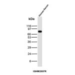 Recombinant IgM Antibody IGHM/2557R in Human Serum WB. Western blot testing of human serum with Recombinant IgM Antibody clone IGHM/2557R detects a strong, discrete band at approximately 75 kDa, consistent with the expected size of the immunoglobulin mu heavy chain. Minimal additional reactivity is visible under the tested conditions, producing a clean Western blot signal. This Recombinant Immunoglobulin M Antibody recognizes the heavy chain component of human IgM.