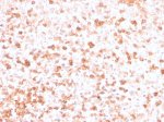 IHC staining of FFPE human tonsil with recombinant Lambda Light Chain antibody (clone rLLC/3777). HIER: boil tissue sections in pH 9 10mM Tris with 1mM EDTA for 20 min and allow to cool before testing.