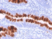 Fas Antibody Colon IHC. Immunohistochemistry analysis of FFPE human colon tissue using FAS Antibody (clone FAS/3112) demonstrates strong HRP-DAB brown cytoplasmic and membranous staining along colonic crypt epithelial cells, highlighting CD95 / FAS as a key apoptosis receptor involved in regulating epithelial homeostasis and extrinsic cell death pathways, while adjacent stromal cells show minimal background; nuclei are counterstained blue. HIER: boil tissue sections in pH 9 10 mM Tris with 1 mM EDTA for 20 min and allow to cool before testing.