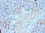 CD95 Antibody Human Tonsil Tissue IHC. Immunohistochemistry analysis of FFPE human tonsil tissue using CD95 Antibody (clone FAS/3588) demonstrates HRP-DAB brown membranous and cytoplasmic staining in lymphoid cells within germinal center and interfollicular regions, consistent with CD95 / FAS as an immune apoptosis marker regulating lymphocyte activation and programmed cell death, while surrounding stromal elements show minimal background; nuclei are counterstained blue. HIER: boil tissue sections in pH 9 10 mM Tris with 1 mM EDTA for 20 min and allow to cool before testing.