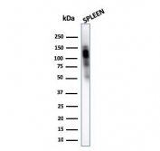 Western blot testing of human spleen lysate with CD11b antibody (clone ITGAM/3340). Expected molecular weight: 127~170 kDa depending on glycosylation level.
