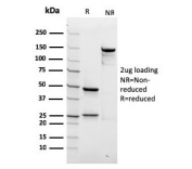 SDS-PAGE analysis of purified, BSA-free recombinant Spectrin beta III antibody (clone rSPTBN2/1778) as confirmation of integrity and purity.
