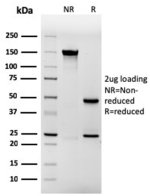 Purified IVRN Antibody rIVRN/827 SDS-PAGE. SDS-PAGE analysis of purified, BSA-free IVRN Antibody clone rIVRN/827 under non-reducing (NR) and reducing (R) conditions with a 2 ug antibody load. The non-reduced preparation shows a predominant intact antibody band at approximately 150 kDa. Under reducing conditions, the antibody resolves into approximately 50 kDa heavy-chain and 25 kDa light-chain bands. The expected electrophoretic profile demonstrates the integrity of the purified recombinant mouse Involucrin Monoclonal Antibody preparation.