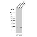 ADP-Ribosylation Factor 1 Antibody ARF1/2117 in Human Tissues WB. Western blot analysis of human tissue lysates with ADP-Ribosylation Factor 1 Antibody clone ARF1/2117. Lane 1: brain; lane 2: pancreas; lane 3: lung. A discrete band is detected at approximately 20-21 kDa in all three tissues, consistent with the expected molecular weight of ARF1. Brain and lung show stronger signal than pancreas, while little additional reactivity is visible across the blot. The clean target-sized bands demonstrate endogenous ARF1 detection in multiple human tissues and reinforce western blot performance of the ARF1 Monoclonal Antibody.