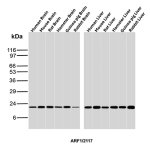 ADP-Ribosylation Factor 1 Antibody ARF1/2117 Across Six Mammalian Species WB. Western blot analysis of brain and liver tissue lysates with ADP-Ribosylation Factor 1 Antibody clone ARF1/2117. Brain lanes: human, mouse, rat, hamster, guinea pig and rabbit. Liver lanes: human, mouse, rat, hamster, guinea pig and rabbit. A strong, discrete band is detected at approximately 20-21 kDa across all twelve samples, consistent with the expected molecular weight of ARF1. The remarkably uniform target-sized signal and minimal additional reactivity demonstrate broad cross-species recognition and strong western blot performance of the ARF1 Monoclonal Antibody.