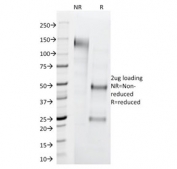SDS-PAGE analysis of purified, BSA-free Cytokeratin 1 antibody (clone LHK1) as confirmation of integrity and purity.