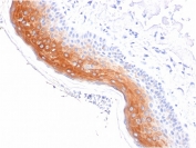 IHC staining of FFPE human skin with CK1 antibody (clone KRT1/1840). HIER: boil tissue sections in pH 9 10mM Tris with 1mM EDTA for 20 min and allow to cool before testing.