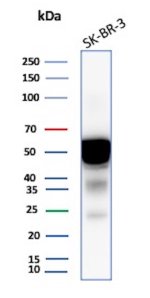 Western blot testing of human SK-BR-3 cell lysate with Cytokeratin 7 Antibody KRT7/2200. Predicted molecular weight ~51 kDa.