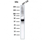 Cytokeratin 8 Antibody HCT116 WB. Western blot analysis of human HCT116 cell lysate using Cytokeratin 8 Antibody / Protein Microarray Validated Antibody (clone KRT8/2115) demonstrates a prominent immunoreactive band at approximately 56 kDa. The observed molecular weight is consistent with the predicted size of Keratin 8 (KRT8), a type II intermediate filament protein that serves as a major structural component of simple epithelial cells. Detection of the expected target in HCT116 colorectal carcinoma cells is consistent with the established expression of KRT8 in epithelial-derived tissues and malignancies. The observed immunoreactivity demonstrates the utility of this antibody for studies of epithelial differentiation, intermediate filament organization, cytoskeletal biology, tumor cell characterization, and epithelial-derived cancer research. Observed molecular weight: ~56 kDa. Expected molecular weight: ~56 kDa.