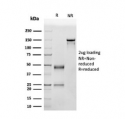 SDS-PAGE analysis of purified, BSA-free p53 Antibody Clone SPM514 / TP53 Tumor Suppressor Antibody as confirmation of integrity and purity.