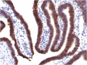EpCAM Antibody Fallopian Tube IHC. Immunohistochemistry staining of FFPE human fallopian tube tissue using EpCAM Antibody (clone EGP40/1373) demonstrates strong membranous and apical HRP-DAB brown staining throughout the columnar epithelial lining of the mucosal folds. The staining pattern is consistent with expression of Epithelial Cell Adhesion Molecule (EPCAM/CD326), a transmembrane glycoprotein involved in epithelial cell adhesion, tissue organization, and maintenance of epithelial integrity. Prominent membrane-associated staining sharply delineates the highly folded epithelial architecture of the fallopian tube and is consistent with the established expression of EpCAM in normal glandular and mucosal epithelial tissues. The observed immunoreactivity supports the use of EpCAM as a marker for epithelial cell identification, epithelial differentiation studies, and characterization of epithelial-derived tissues. HIER: boil tissue sections in pH 9 Tris-EDTA buffer (10 mM Tris, 1 mM EDTA) for 10-20 minutes and allow to cool before testing.