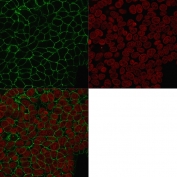 Immunofluorescent staining of human MCF7 cells with EpCAM antibody (clone HEA125, green) and Reddot nuclear stain (red).