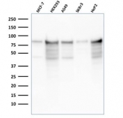 MCM7 Antibody Recombinant Mouse MAb rMCM7/1468 - western blot analysis. Western blot testing of human cell lysates using MCM7 Antibody Recombinant Mouse MAb rMCM7/1468. Lane 1: MCF7 cell lysate, Lane 2: HEK293 cell lysate, Lane 3: A549 cell lysate, Lane 4: SKBR3 cell lysate, Lane 5: HeP2 cell lysate. A band is detected at approximately 80-90 kDa, consistent with the predicted molecular weight of Minichromosome maintenance protein 7 / MCM7. Additional lower bands may represent lower molecular weight MCM7 forms or partial proteolytic degradation products, as MCM7 has been reported in the literature as an approximately 82-85 kDa doublet or broad band on immunoblot analysis.