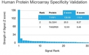Analysis of HuProt(TM) microarray containing more than 19,000 full-length human proteins using TRP1 antibody (clone TYRP1/3283). These results demonstrate the foremost specificity of the TYRP1/3283 mAb. Z- and S- score: The Z-score represents the strength of a signal that an antibody (in combination with a fluorescently-tagged anti-IgG secondary Ab) produces when binding to a particular protein on the HuProt(TM) array. Z-scores are described in units of standard deviations (SD's) above the mean value of all signals generated on that array. If the targets on the HuProt(TM) are arranged in descending order of the Z-score, the S-score is the difference (also in units of SD's) between the Z-scores. The S-score therefore represents the relative target specificity of an Ab to its intended target.