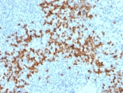 Immunohistochemistry analysis of MMP9 / Matrix metalloproteinase 9 antibody (clone 2C3) in human spleen tissue. FFPE human spleen section shows prominent cytoplasmic brown chromogenic staining in scattered immune cells within the splenic parenchyma, consistent with MMP9 expression, while surrounding lymphoid cells display minimal staining and nuclei appear blue. Heat-induced epitope retrieval was performed by boiling tissue sections in pH 9 10 mM Tris with 1 mM EDTA for 20 minutes followed by cooling prior to staining.