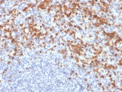 Immunohistochemistry analysis of MMP9 / Matrix metalloproteinase-9 antibody (clone MMP9/2477) in human spleen tissue. FFPE human spleen section shows prominent cytoplasmic brown chromogenic staining in scattered immune cells within the splenic parenchyma, consistent with MMP9 expression, while surrounding lymphoid cells exhibit minimal staining and nuclei appear blue. Heat-induced epitope retrieval was performed by boiling tissue sections in pH 9 10 mM Tris with 1 mM EDTA for 20 minutes followed by cooling prior to staining.