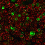 MSH2 Antibody for Immunofluorescence / MSH2 IF Antibody (clone MSH2/2622). Immunofluorescence analysis of permeabilized human MOLT-4 cells stained with MSH2 Antibody for Immunofluorescence (clone MSH2/2622). MutS homolog 2 / MSH2 is visualized as bright nuclear fluorescence (green) with punctate nuclear staining consistent with localization of the DNA mismatch repair protein within the nucleus. Phalloidin staining (red) highlights the actin cytoskeleton and cell boundaries, providing structural context for the nuclear MSH2 signal.